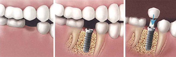 cirugia-maxilofacial-12092017153621_1.jpg